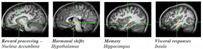 Brain Circuit Nodes Teen Anticipation